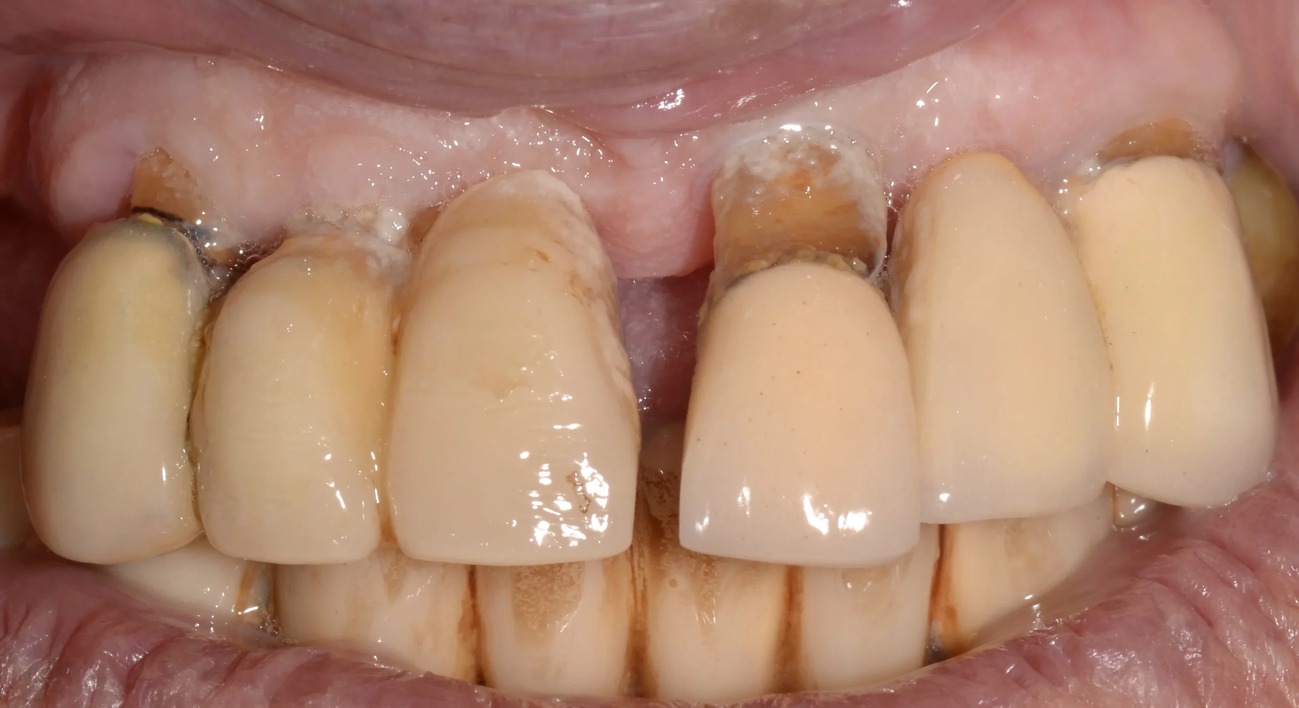 6 before extraction DSC_grasso1844